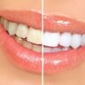 Cómo blanquear dientes en casa de forma natural
