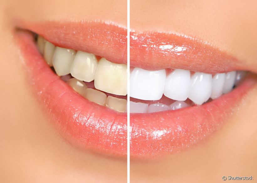 Cómo blanquear dientes en casa de forma natural