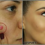Cómo disimular granos con maquillaje sin dañar la piel